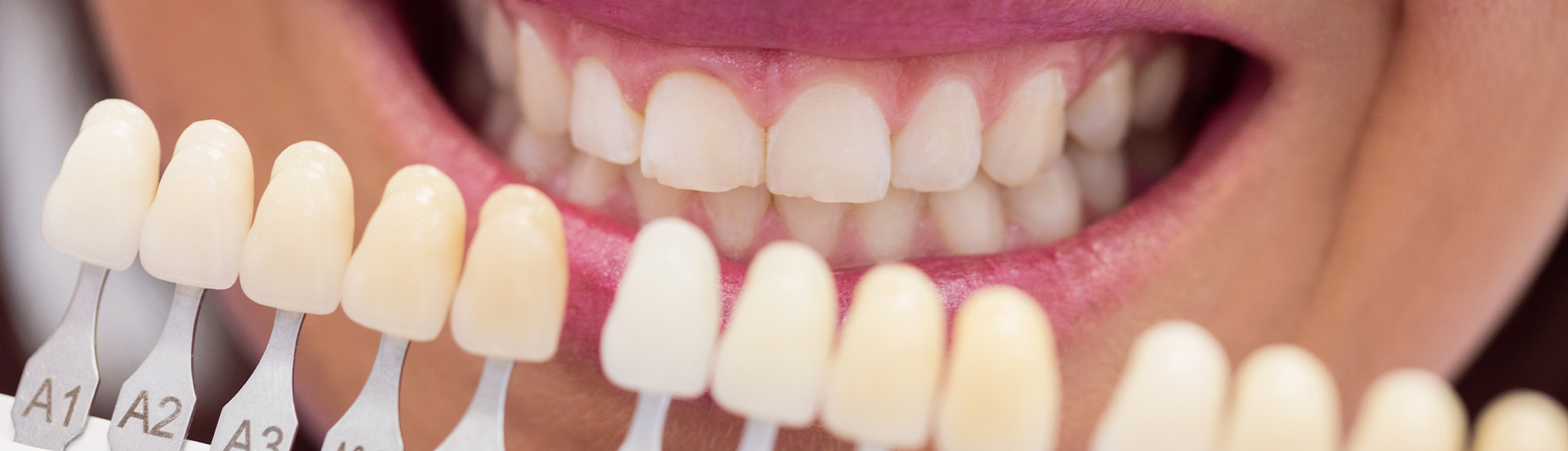 Costa Rica Experience